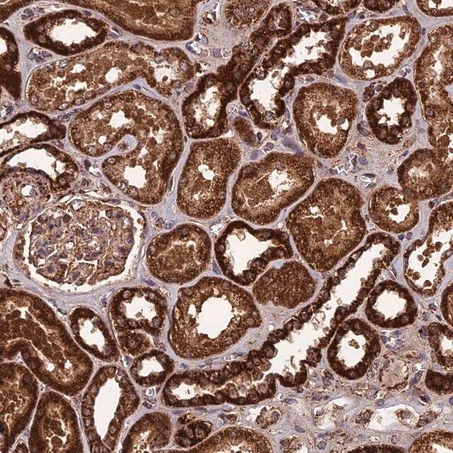Anti-CCDC15 antibody produced in rabbit