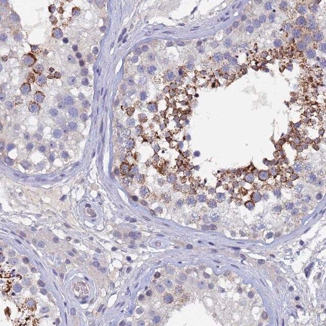 Anti-CCDC36 antibody produced in rabbit