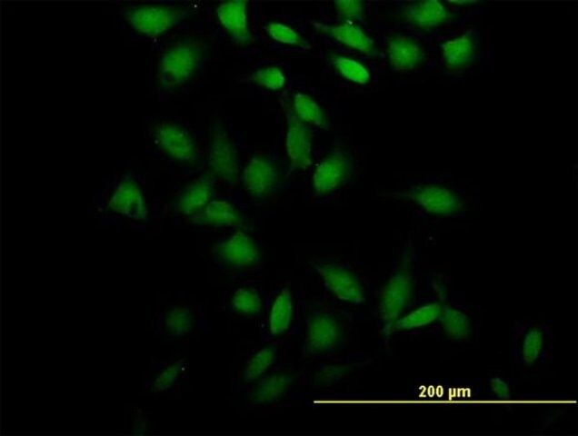 Anti-CCDC131 antibody produced in mouse
