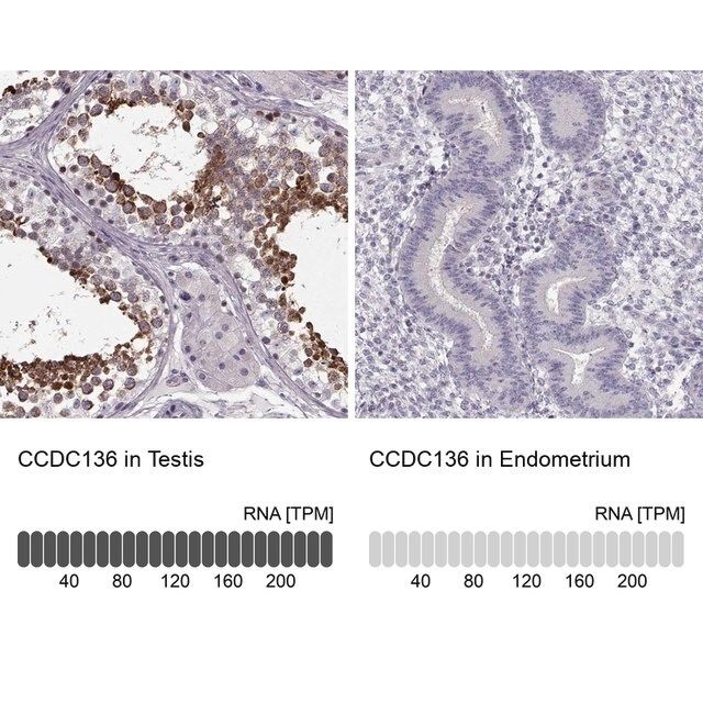 Anti-CCDC136 antibody produced in rabbit