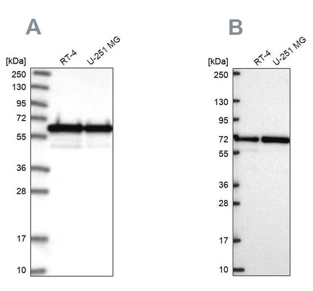 Anti-CCDC47 antibody produced in rabbit