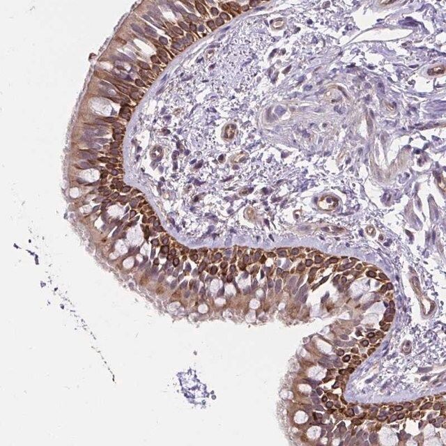 Anti-CCDC122 antibody produced in rabbit