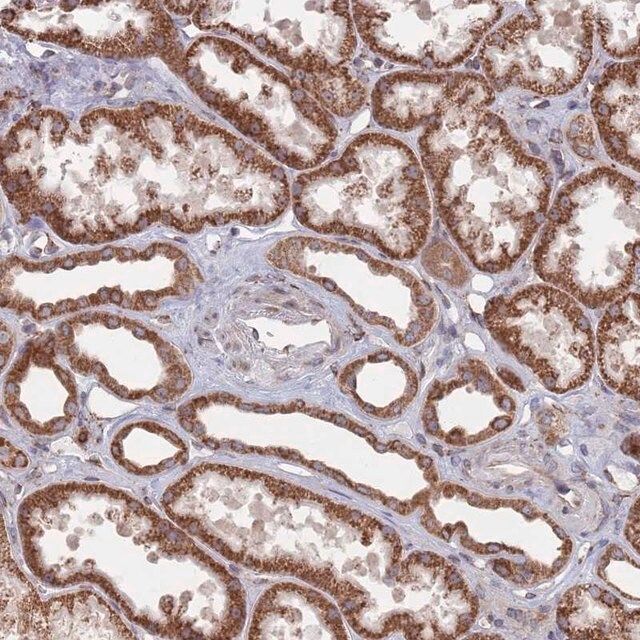 Anti-CCDC106 antibody produced in rabbit