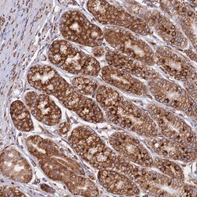 Anti-CCDC69 antibody produced in rabbit