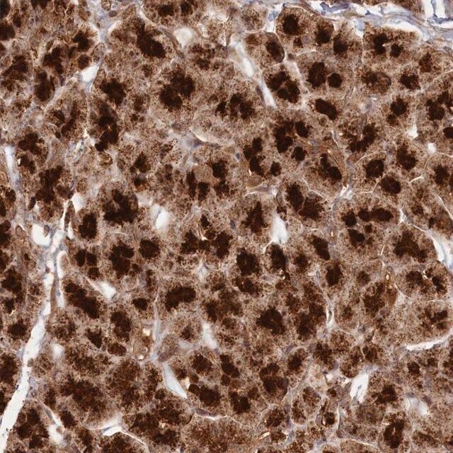 Anti-CCDC174 antibody produced in rabbit