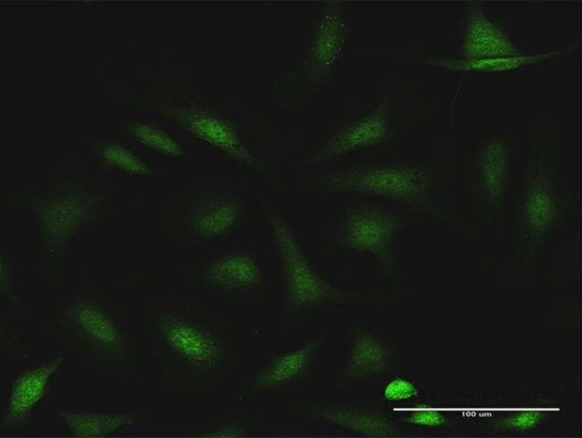 Anti-CCDC6 antibody produced in rabbit