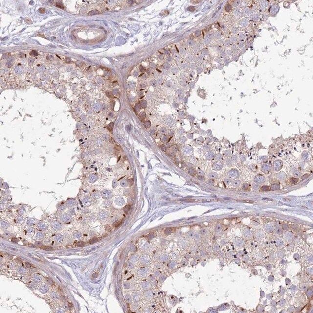 Anti-CCDC150 antibody produced in rabbit