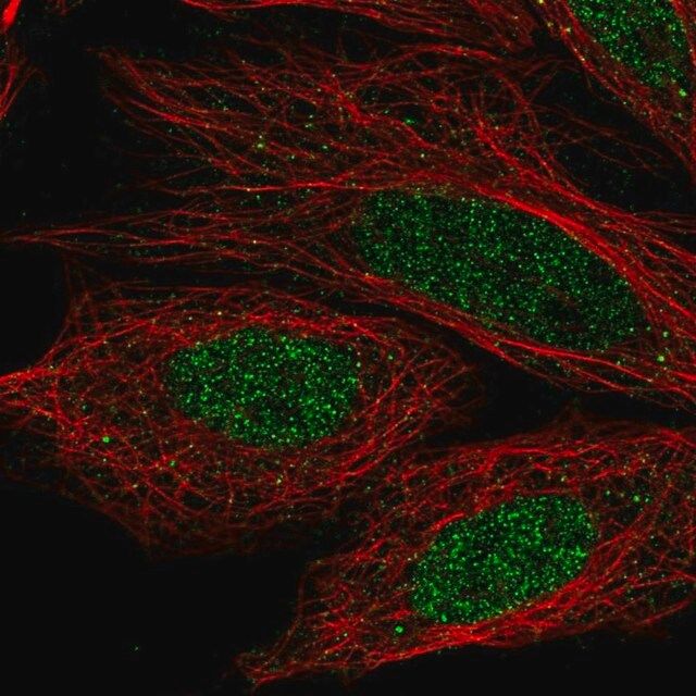 Anti-CCDC36 antibody produced in rabbit