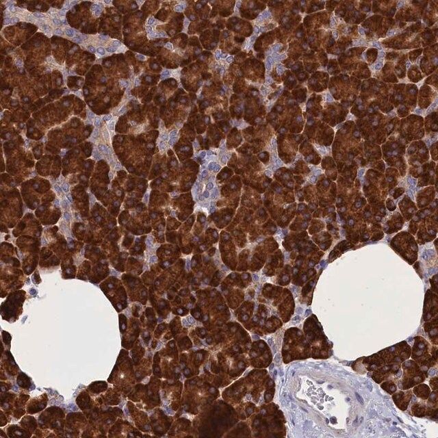 Anti-CCDC68 antibody produced in rabbit