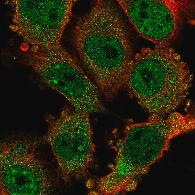 Anti-CCDC159 antibody produced in rabbit