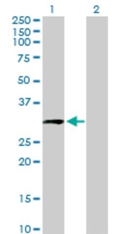 Anti-CCDC5 antibody produced in mouse