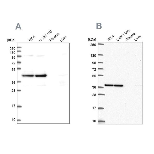 Anti-CCDC94 antibody produced in rabbit