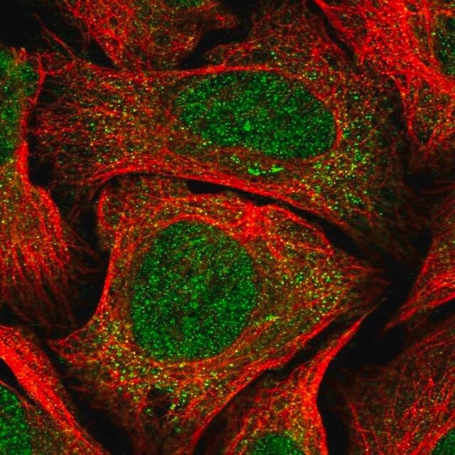 Anti-CCDC138 antibody produced in rabbit