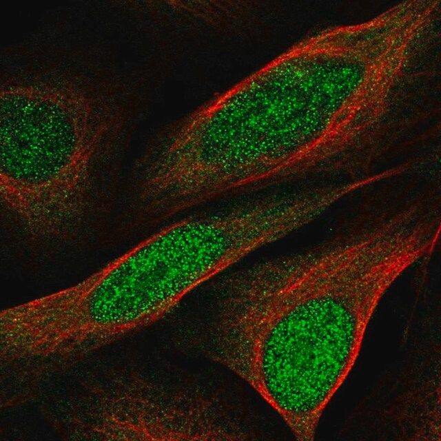Anti-CCDC3 antibody produced in rabbit