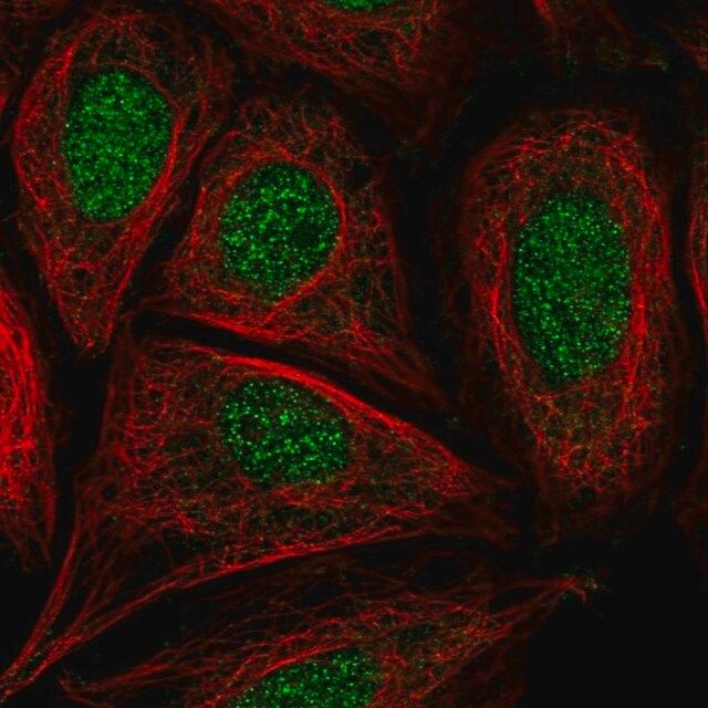 Anti-CCDC61 antibody produced in rabbit