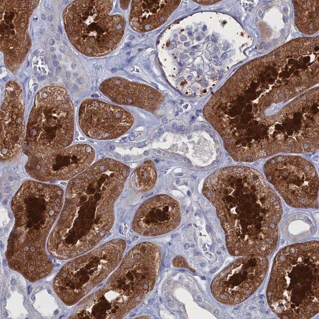 Anti-CCDC149 antibody produced in rabbit
