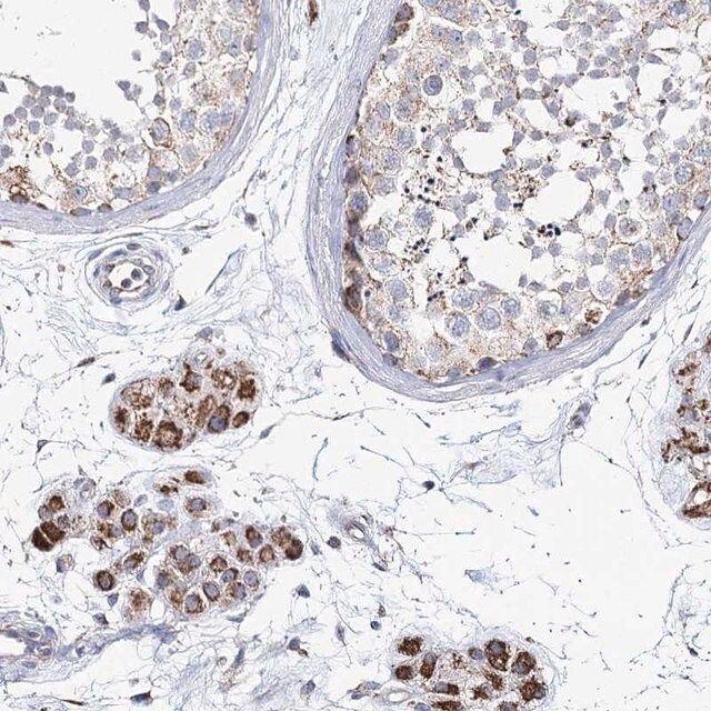 Anti-CCDC73 antibody produced in rabbit