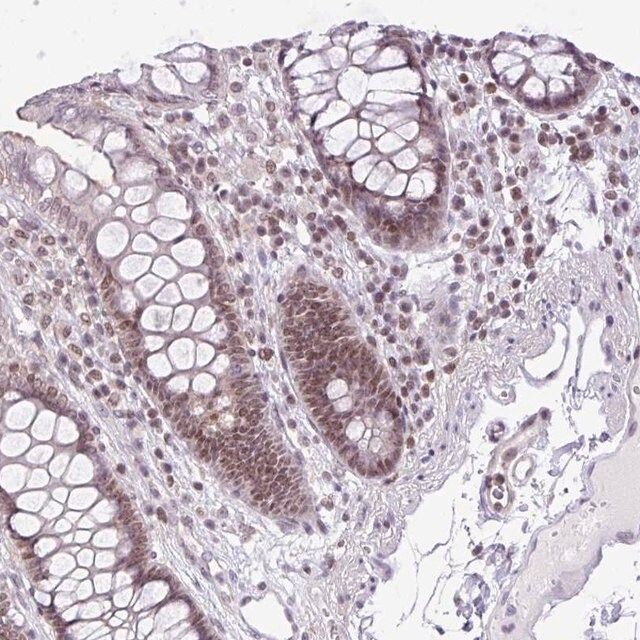 Anti-CCDC137 antibody produced in rabbit