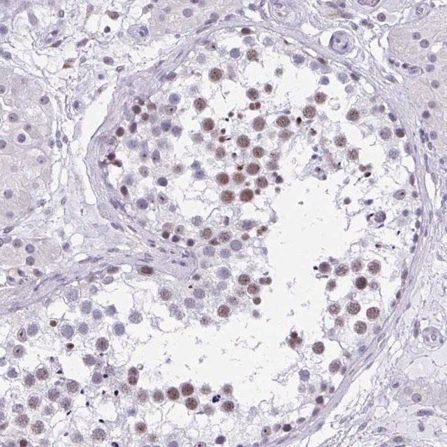 Anti-CCDC105 antibody produced in rabbit