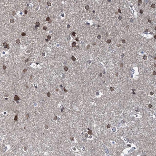 Anti-CCDC34 antibody produced in rabbit