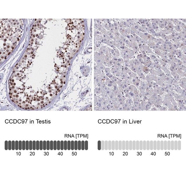 Anti-CCDC97 antibody produced in rabbit