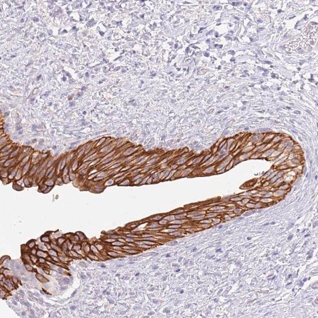 Anti-CCDC149 antibody produced in rabbit