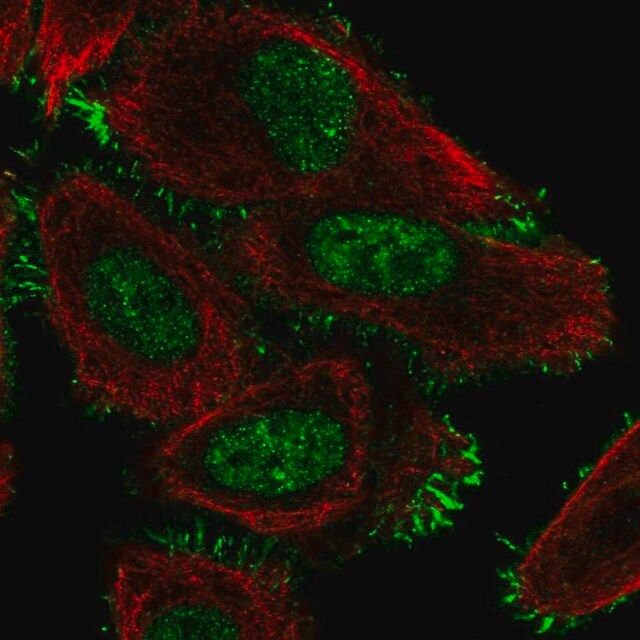 Anti-CCDC107 antibody produced in rabbit