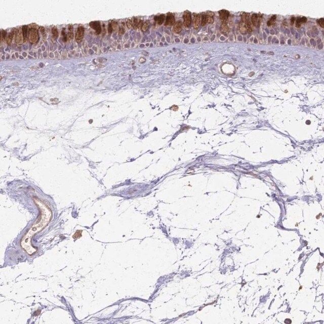 Anti-CCDC168 antibody produced in rabbit