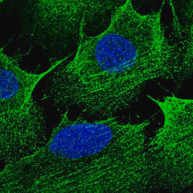 Anti-CCDC69 antibody produced in rabbit