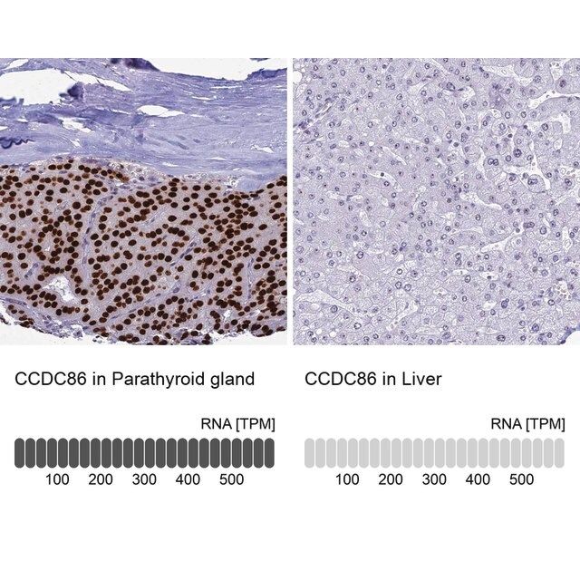 Anti-CCDC86 antibody produced in rabbit