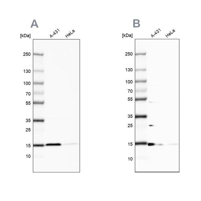 Anti-CCDC58 antibody produced in rabbit