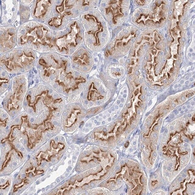 Anti-CCDC73 antibody produced in rabbit