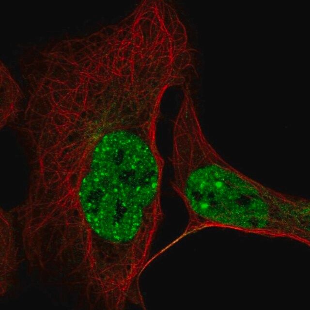 Anti-CCDC188 antibody produced in rabbit
