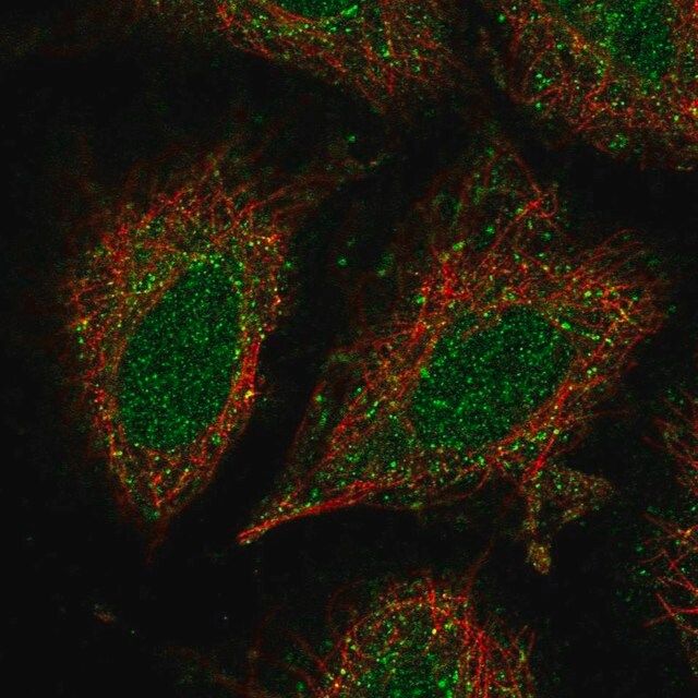 Anti-CCDC122 antibody produced in rabbit