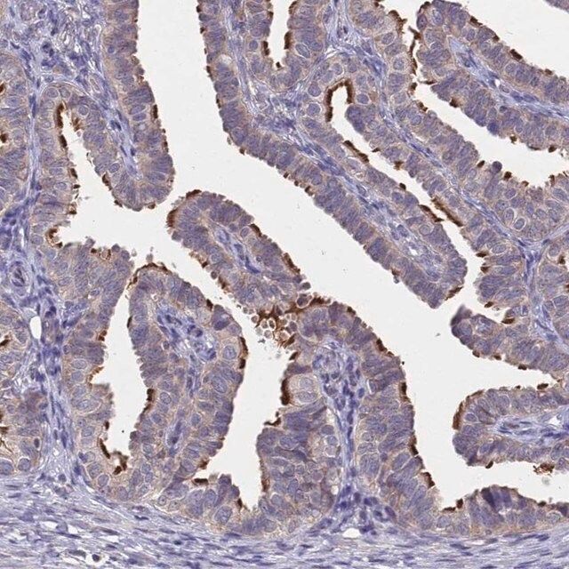 Anti-CCDC189 antibody produced in rabbit