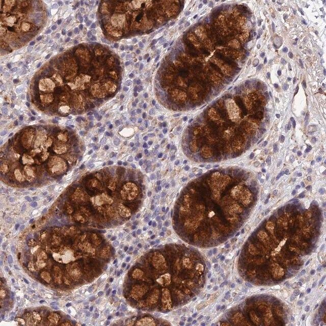 Anti-CCDC66 antibody produced in rabbit