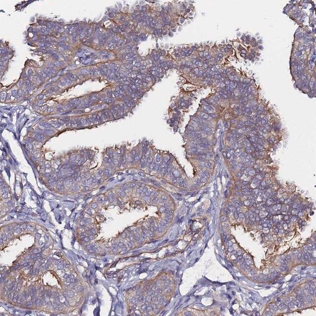 Anti-CCDC13 antibody produced in rabbit