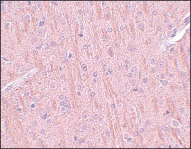 Anti-CCDC106 antibody produced in rabbit