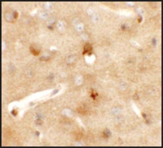 Anti-CCDC141 antibody produced in rabbit