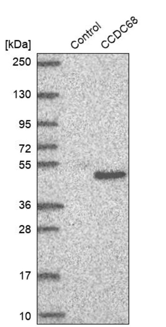Anti-CCDC68 antibody produced in rabbit