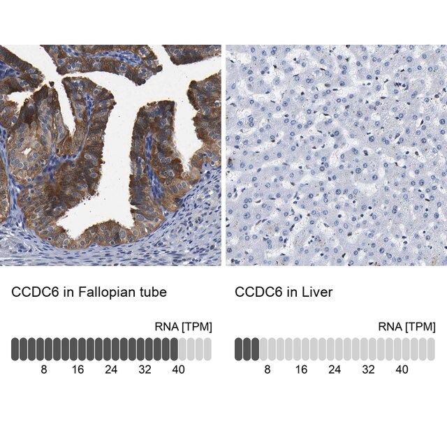 Anti-CCDC6 antibody produced in rabbit