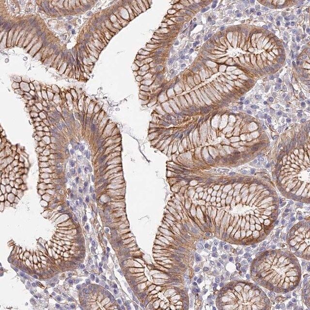Anti-CCDC30 antibody produced in rabbit