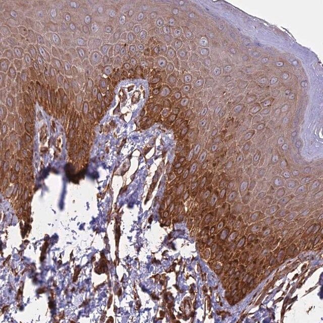 Anti-CCDC148 antibody produced in rabbit