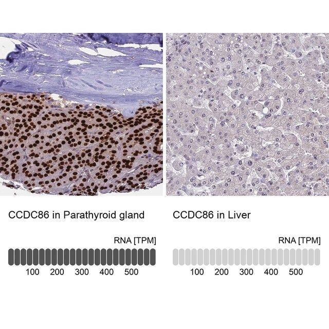 Anti-CCDC86 antibody produced in rabbit