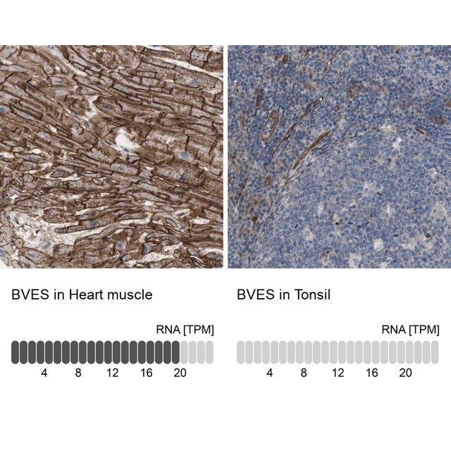 Anti-BVES antibody produced in rabbit