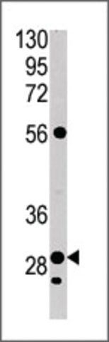 Anti-CA9 (center) antibody produced in rabbit