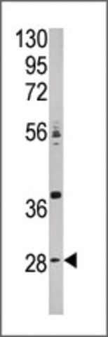 Anti-CA9 (N-term) antibody produced in rabbit