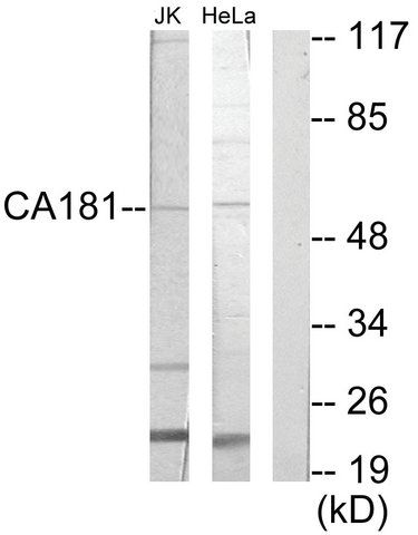 Anti-CA181 antibody produced in rabbit