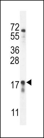 ANTI-CA115 (CENTER) antibody produced in rabbit