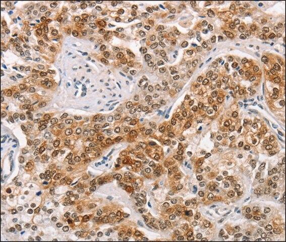 Anti-CABLES1 antibody produced in rabbit